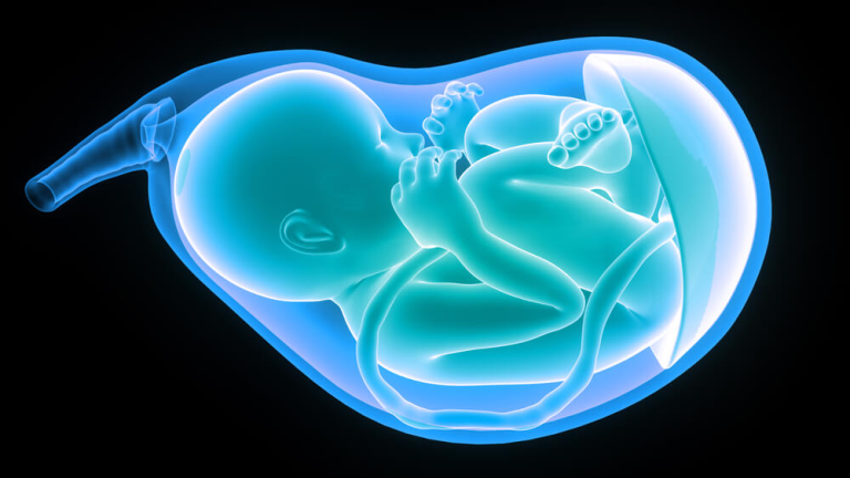 How Do Umbilical Cord Complications Lead to Legal Claims?